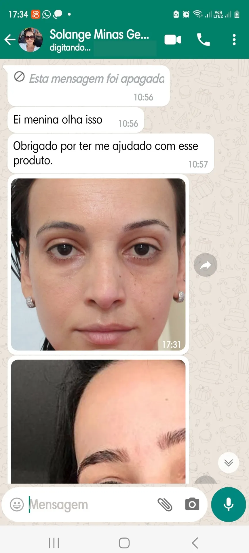 Depoimento real de cliente Amazolé 3